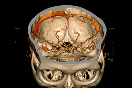 Обнаружена главная опасность курения