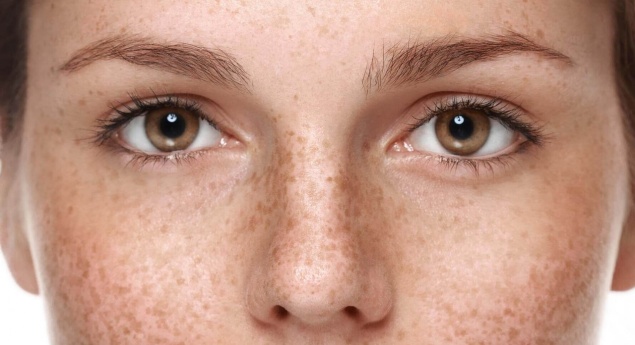 ПИГМЕНТНЫЕ ПЯТНА НА ТЕЛЕ И ЛИЦЕ: ПОЧЕМУ ПОЯВЛЯЮТСЯ, И КАК ОТ НИХ ИЗБАВИТЬСЯ