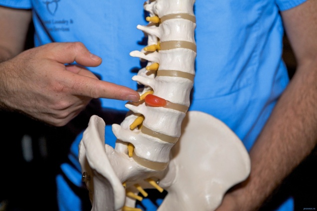 ЛЕЧЕНИЕ МЕЖПОЗВОНОЧНОЙ ГРЫЖИ