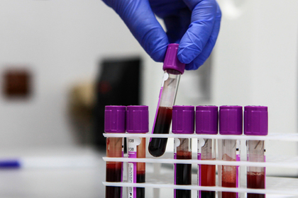 Названы регионы России с выросшей заболеваемостью ВИЧ