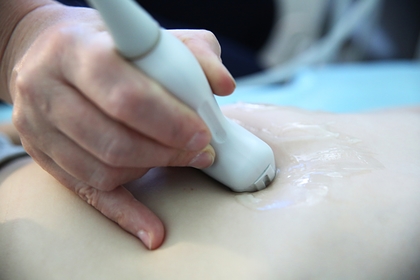 Женщин предупредили о возможном бесплодии из-за коронавируса