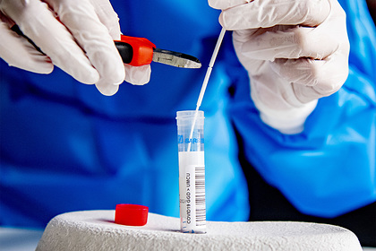 Профессор пожаловался на странные симптомы после выздоровления от коронавируса