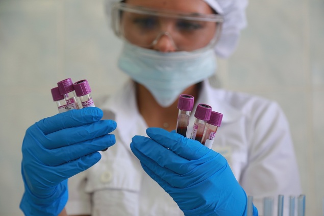 График приема анализов лабораторией Центра СПИД в нерабочие и праздничные дни