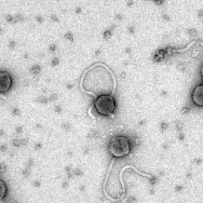Найден хвостатый вирус-уничтожитель сибирской язвы