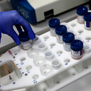 Подсчитаны потери России из-за рака