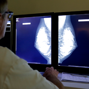 Назван способ избежать распространенный рак