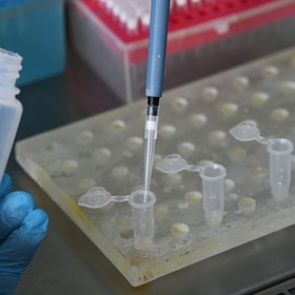 Россия приравняла коронавирус к ВИЧ и чуме