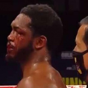 Боксер порвал губу сопернику апперкотом и победил