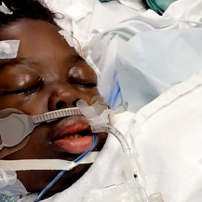 Ребенку придется ампутировать ноги из-за осложнения после COVID-19